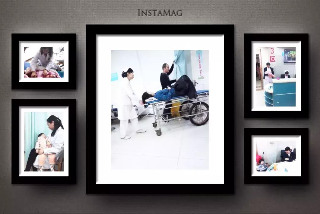 31岁孕妈胎盘早剥致胎死宫内,孕中期摔倒怀疑胎盘早剥