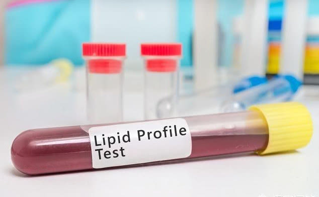 血脂高代谢异常怎么办,血脂代谢异常中医怎么调理好