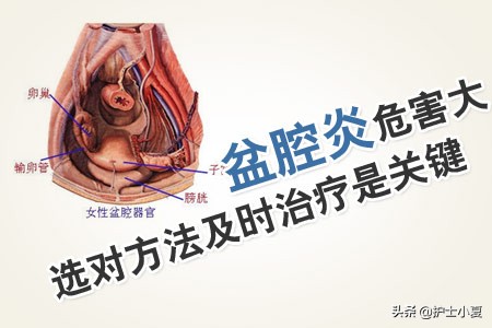 女人得了盆腔炎症该关注哪些,盆腔炎怎么预防和改善