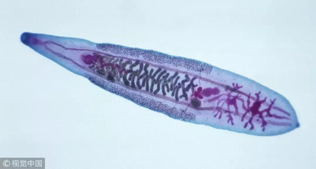 喜欢吃鱼生的会得肝吸虫吗,吃鱼有肝吸虫