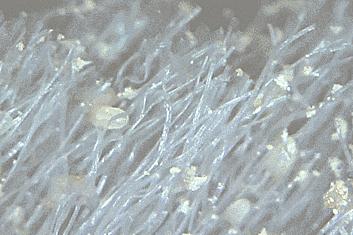 头皮一直出汗痒,头皮多痒出油掉发严重怎么办