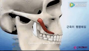 高颧骨脸颊凹妆容,高颧骨有办法改善吗