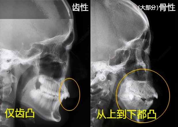 一张嘴毁掉了整张脸,一张嘴毁掉半张脸完整版