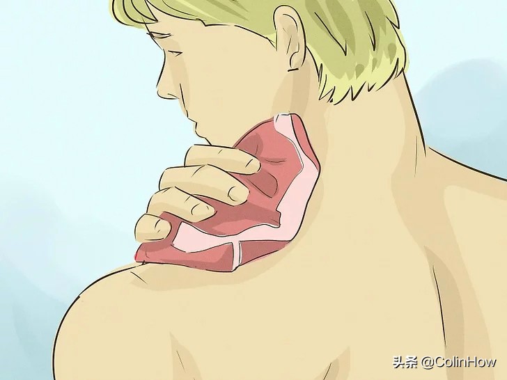 如何去除吻痕,怎么遮盖吻痕