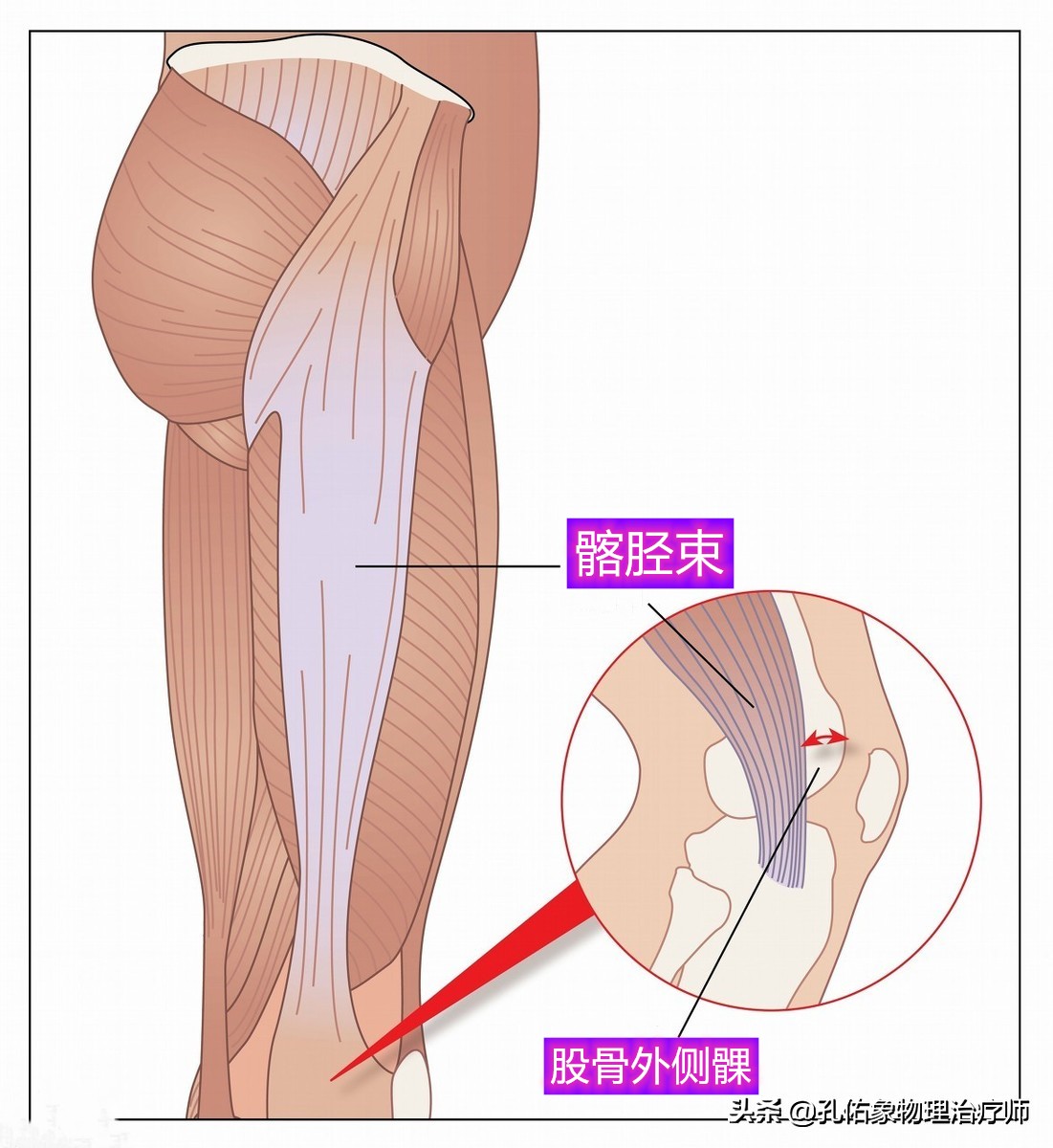 膝关节疼痛位置判断得了什么病,膝关节疼痛一般什么原因引起的