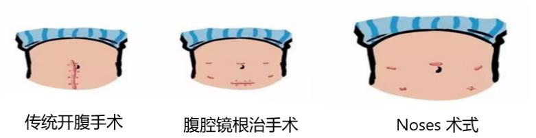 哈医大一院肠息肉手术专家,哈尔滨肿瘤直肠外科专家排名