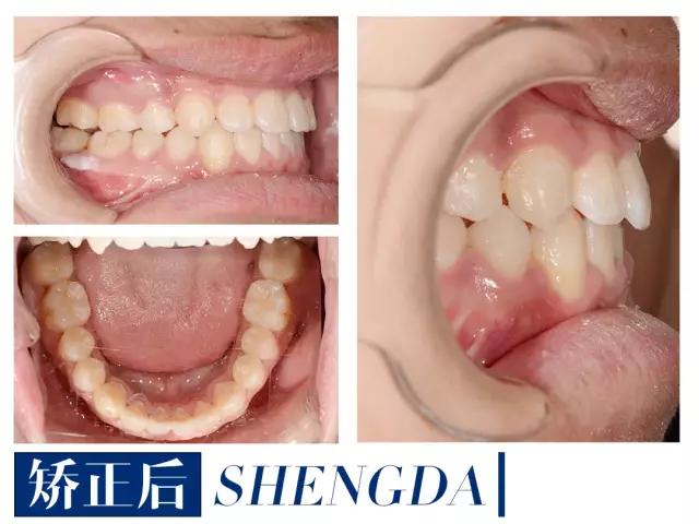 山西“爱马仕”级别齿科医院！get明星同款笑容