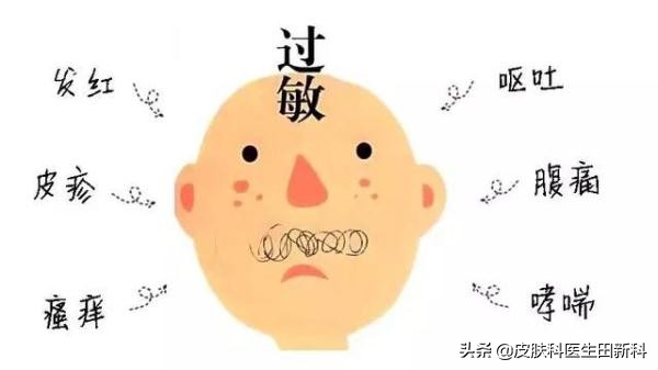 关于荨麻疹的常见认识误区,荨麻疹的常见误区