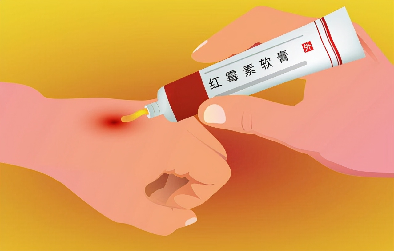 红霉素软膏下面肿可以涂吗,红霉素软膏涂在眼睑内会咋样