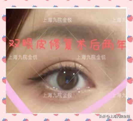 双眼皮VS单眼皮，为什么更多人喜欢双眼皮？