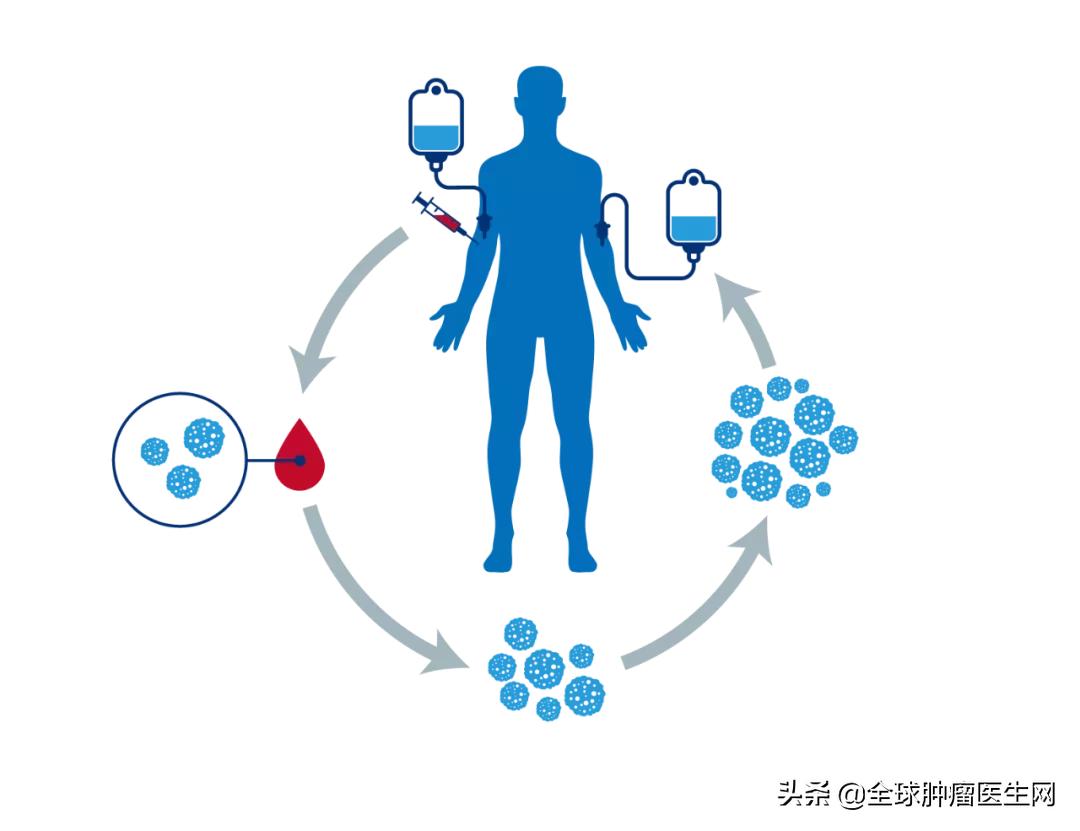 nk细胞治疗癌症晚期有用吗,异体nk细胞肺癌