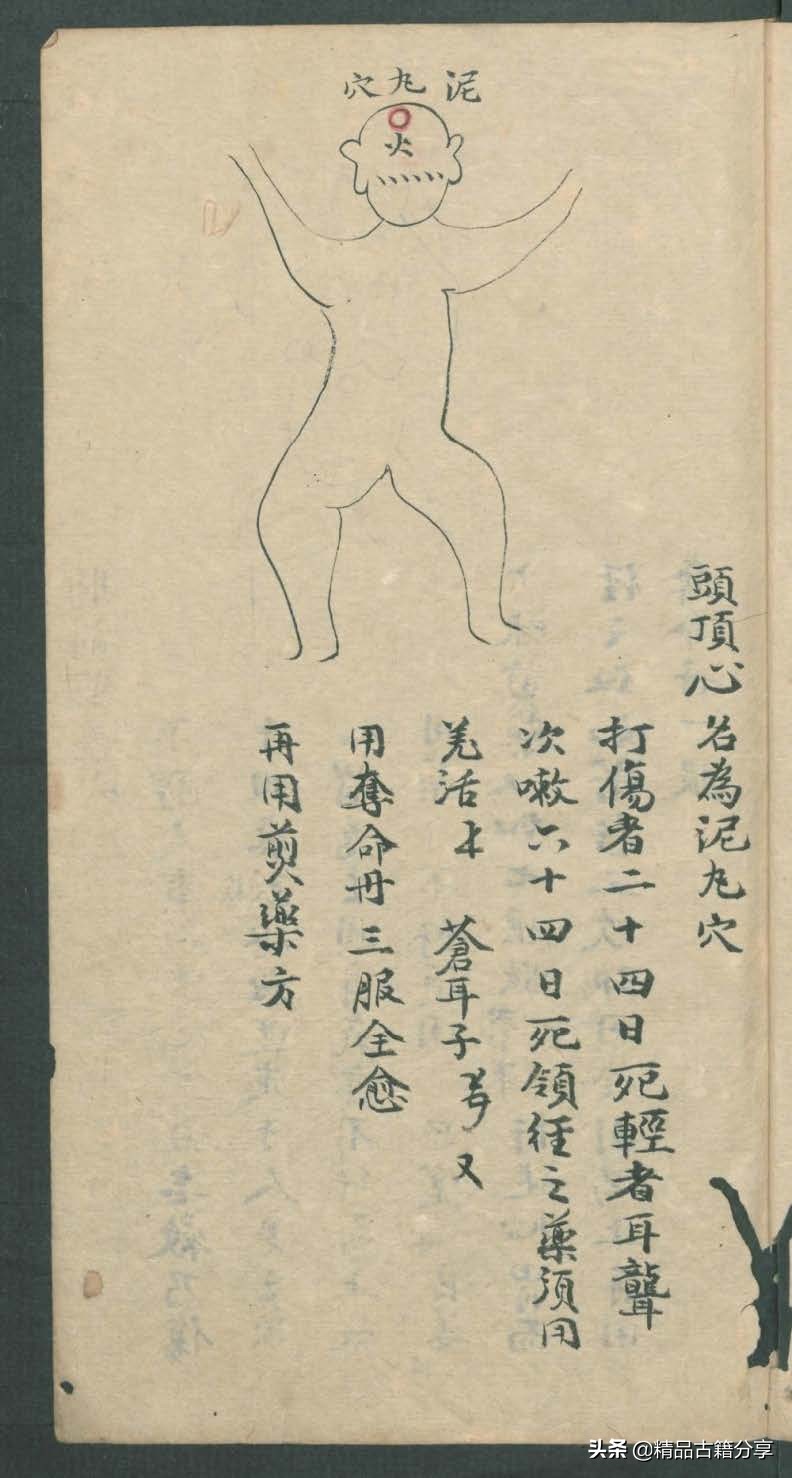 中医类抄本跌打损伤方面的医书欢迎阅读