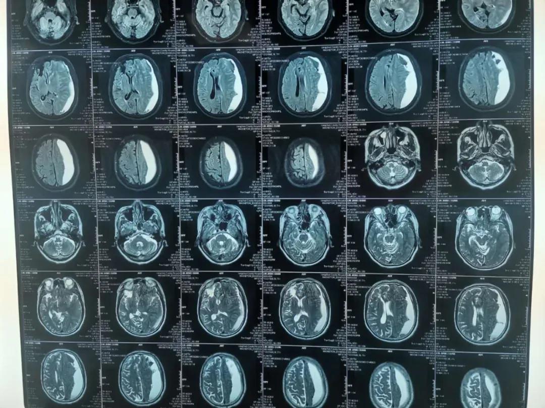 泉州：突破！永春县总医院成功开展新技术