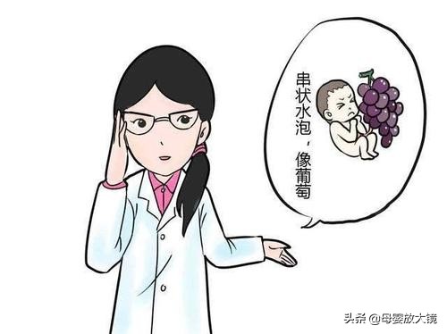在孕早期孕妇应关注哪些问题,孕妈妈需警惕的产前几大症状