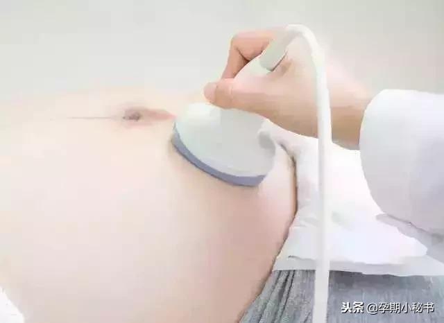 孕期产检必做的几大项,孕期第几周检查大排畸