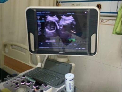 妇产医生扭转胎位,中医胎位倒转术