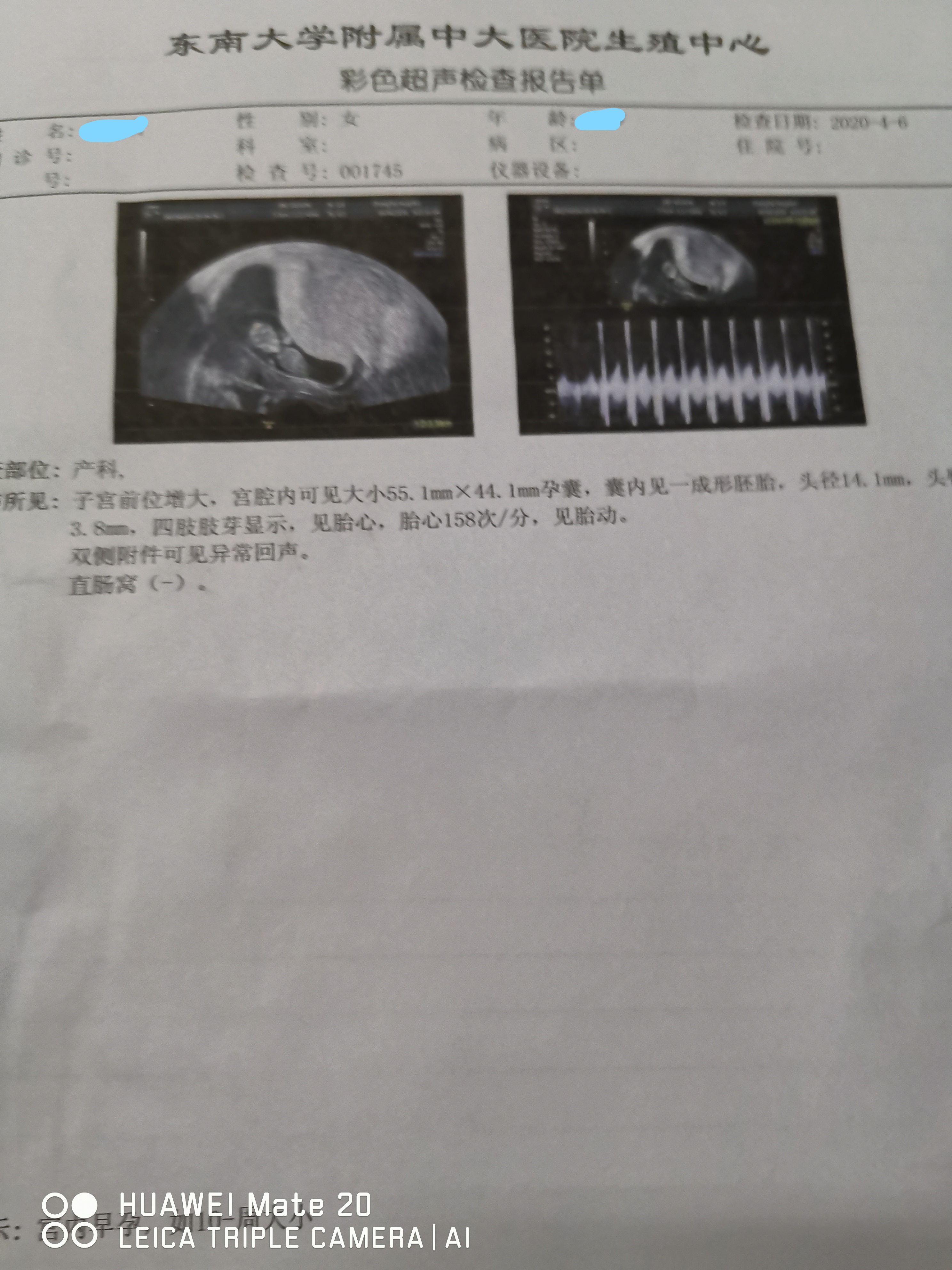 关于排卵障碍型不孕的知识,排卵障碍不孕