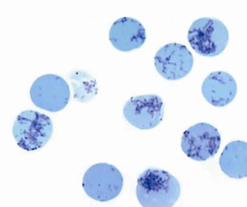贫血为什么要检查网织红细胞,网织红细胞比率偏高原因