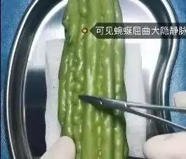 香蕉割包皮，洋葱剖腹产？这是我见过最秀的医生