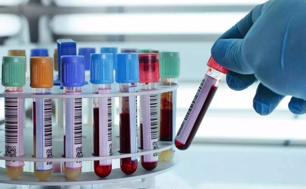 空腹抽血前喝了一口水影响效果吗,抽血为什么要空腹还不能喝水