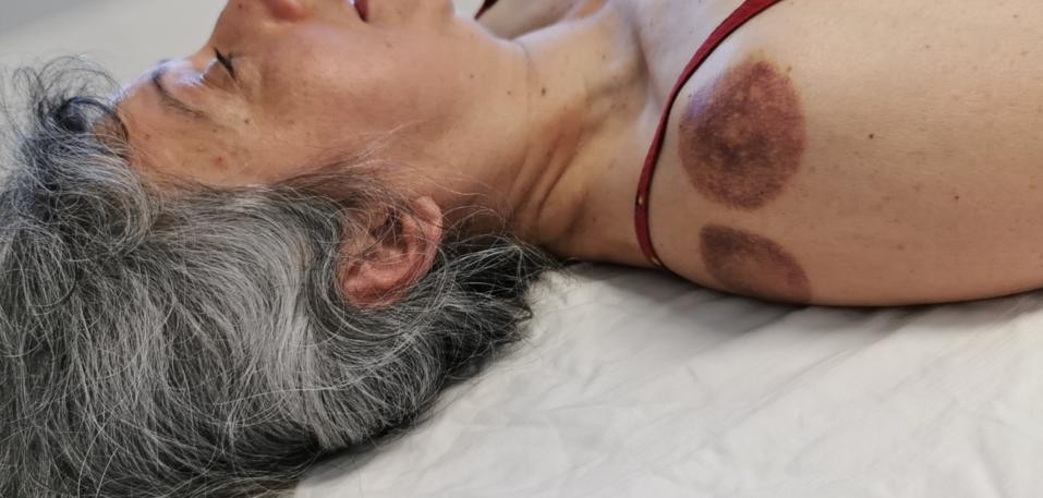 奇经八脉是哪八脉有什么作用,三焦经治疗肩周炎穴位