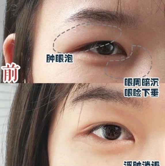 李佳琦推荐5款美容仪,李佳琦推荐的平价国货美容仪