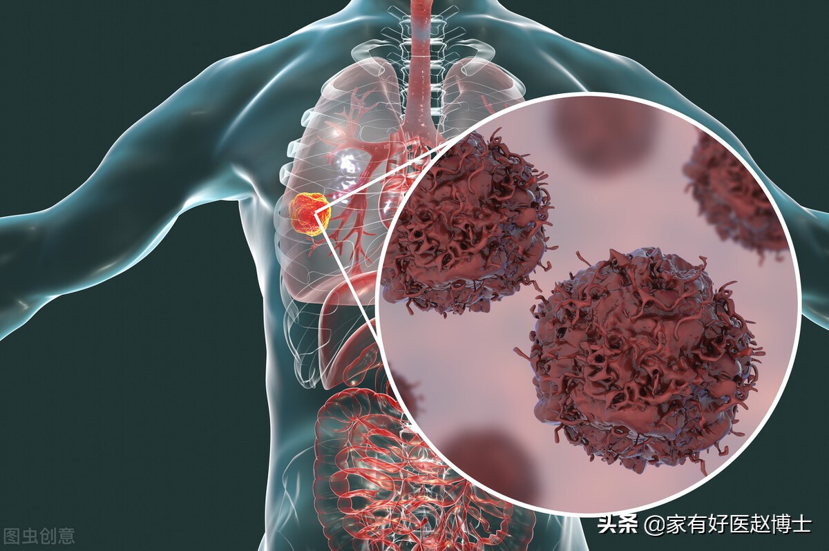 为什么有的人喝咖啡就睡不着,如何避免喝咖啡睡不着觉