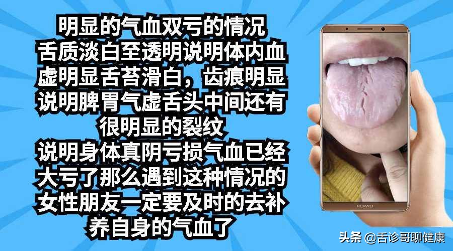 股骨头坏死主诉,股骨头酸痛大脑不舒服