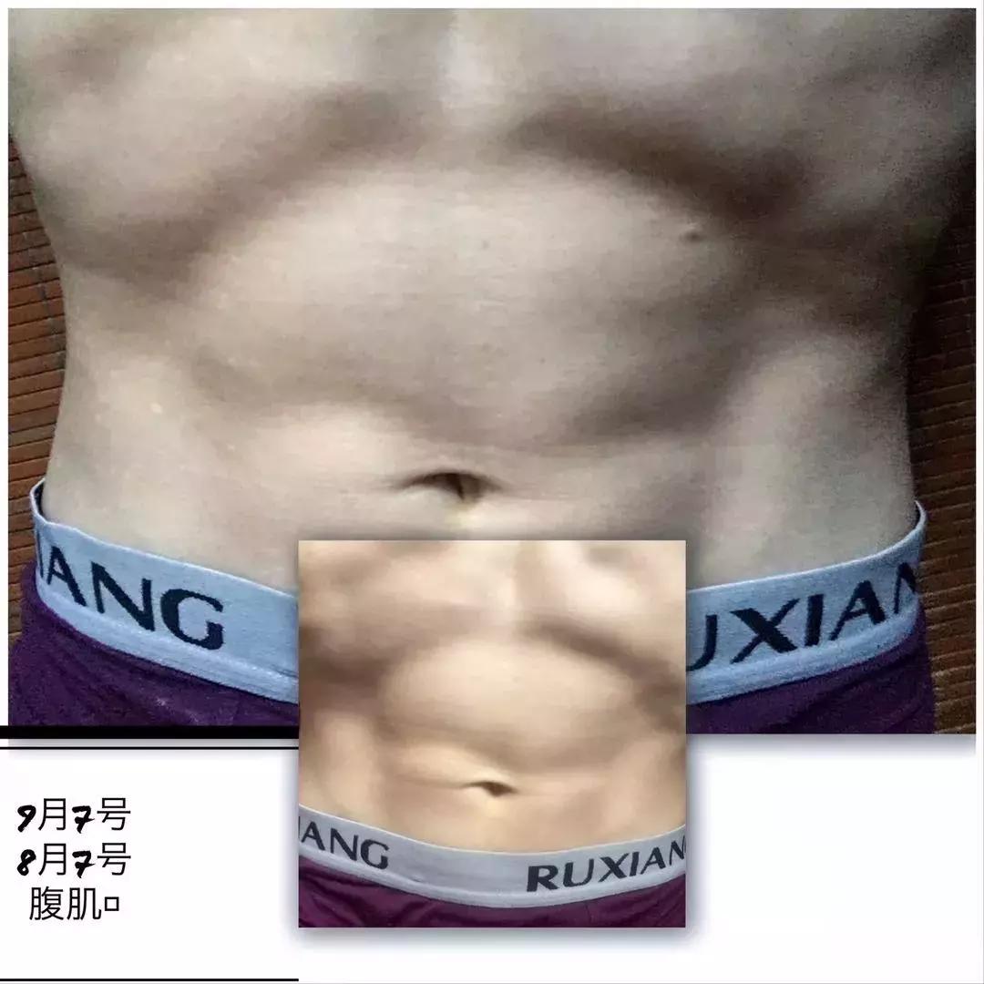 每天跑步五公里治愈癌症,有氧跑步战胜癌症的案例