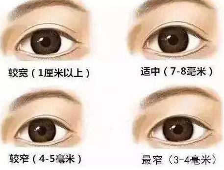 做完双眼皮为什么会有肉条感,做完双眼皮肉条感可以消除嘛