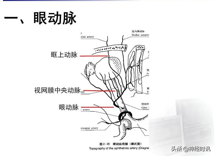 脑动脉解剖学讲解,基底节区脑血管解剖