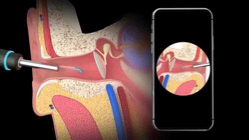 好用的专业采耳棒推荐,专业采耳神器实测