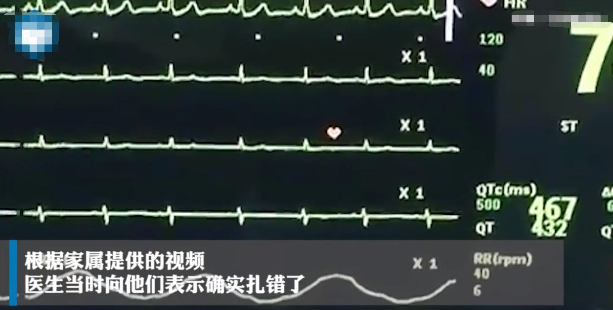 医生扎错穴位导致下半身瘫痪,针灸扎错人导致走火入魔