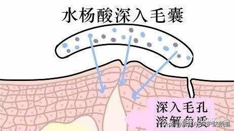 维a酸乳膏,维a酸处方图片