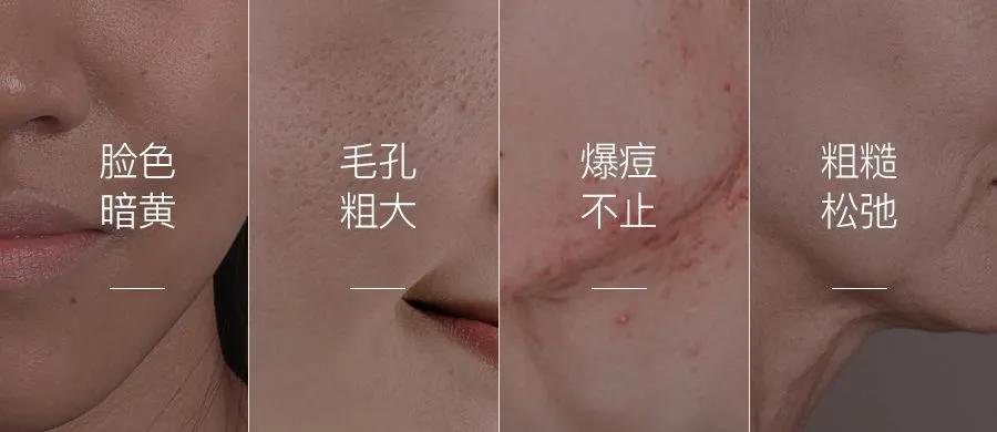 嫩脸“黑”科技，玉鑫妍面膜全面修护“口罩脸”