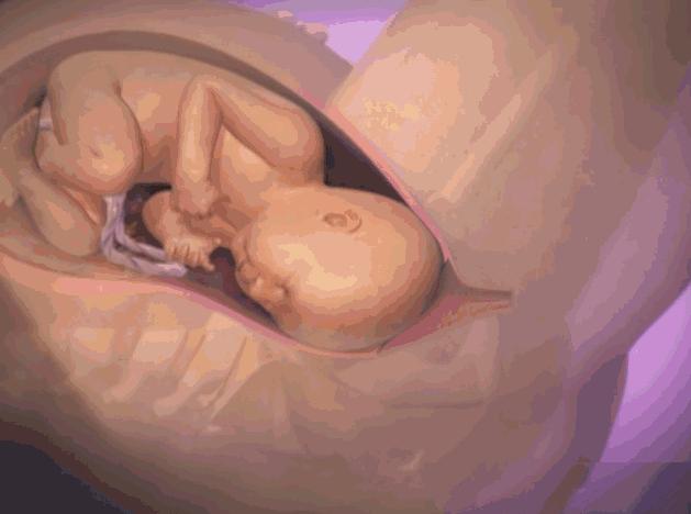 顺产生孩子剖腹产的真实流程,顺产剖腹产生孩子的真实流程
