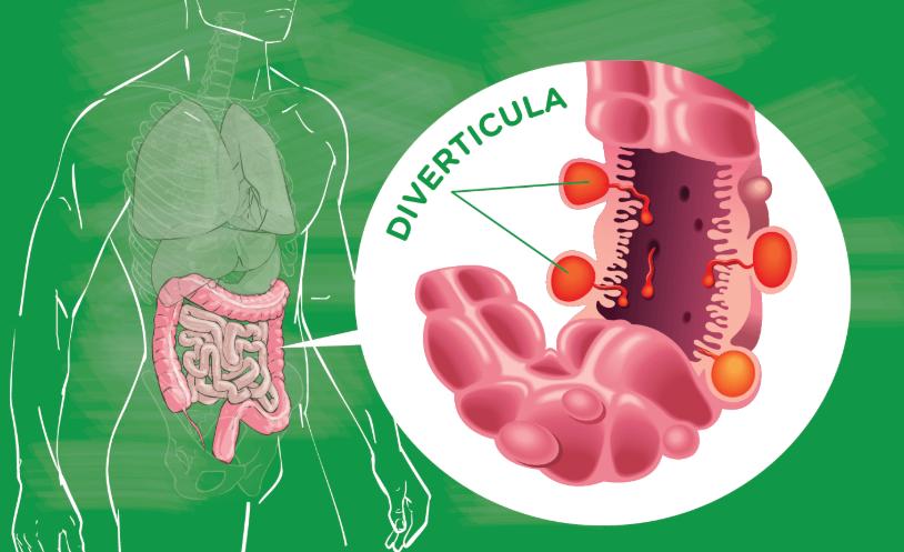 优雅屁学，在线教你闷声放大屁...