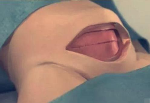 7张图揭露产妇“剖腹产”全过程，男人都该看，网友：母爱太伟大