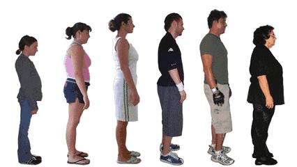 双下巴显脸大怎么改善,双下巴很明显但是不胖