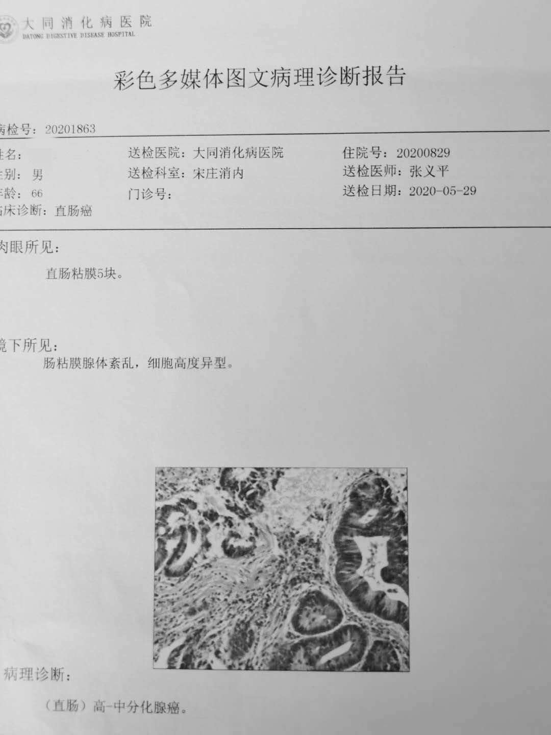 “镜”显风采，大同一专科医院应用3D腹腔镜技术成功为大肠癌患者行手术治疗