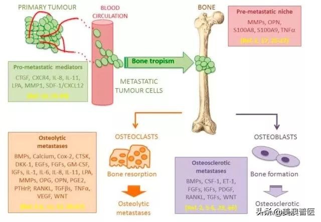 肺癌晚期骨转移有必要化疗吗,肺癌晚期出现骨转移该怎么办