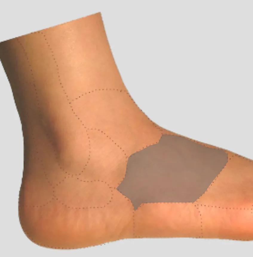 足踝各种疼痛的原因,足踝内侧疼痛自测