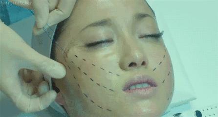 整容毁掉容貌的女子,一名女子整容却毁了她一生