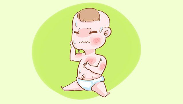孩子容易出痱子怎么办,宝宝擦汗避免热出痱子或凉汗受凉