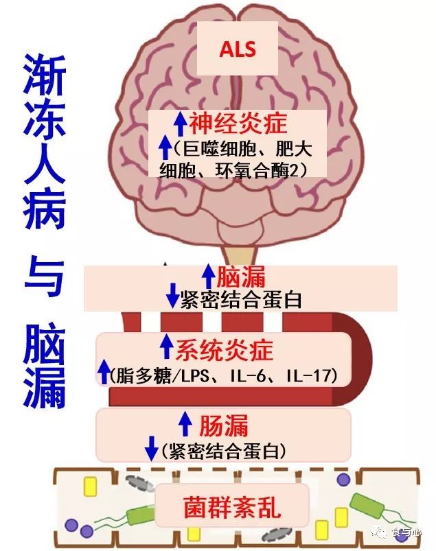 肠漏症的三大指标,肠漏症和脑漏症