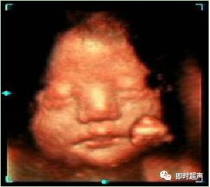 产科常规彩色超声报告单介绍,常见妇科疾病超声报告