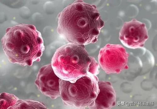 尖锐性湿疣用药还是手术,尖锐性湿疣用激光治疗还是吃药