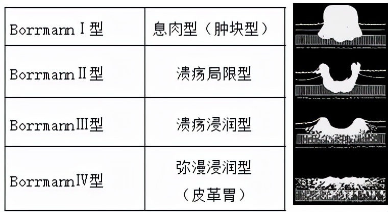 我不是药神，我不是财迷！若患胃癌，这些靶向药你有能力负担吗？