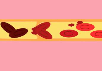 子宫内膜癌的防癌筛查,子宫内膜癌预防与筛查