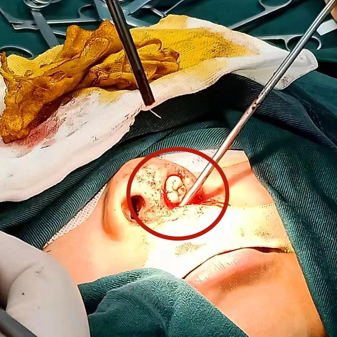 医院里的硬核技术,硬核医生硬核技术